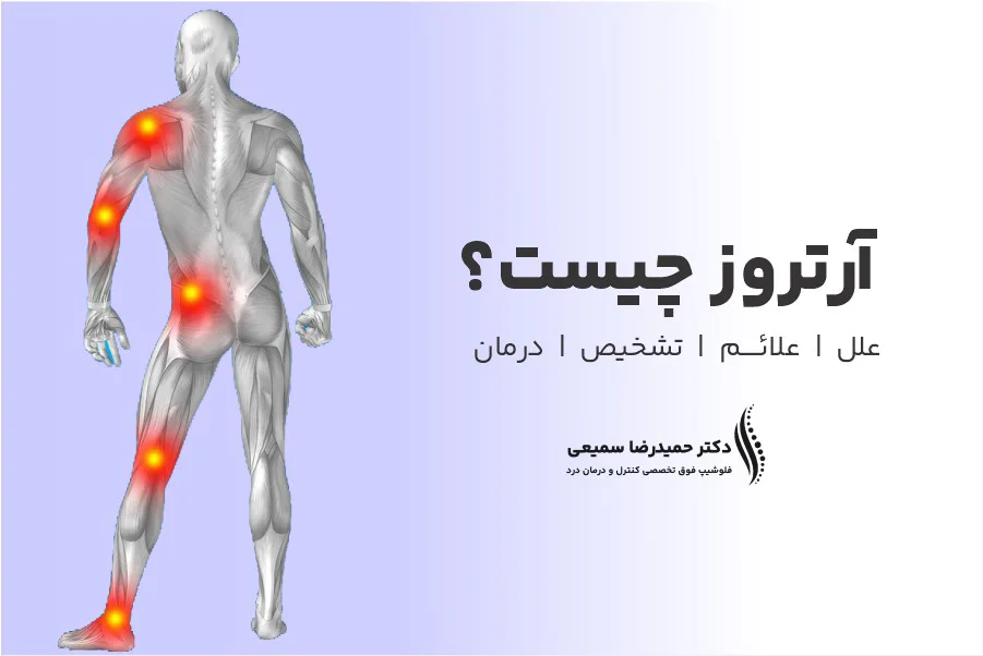 آرتروز چیست؟