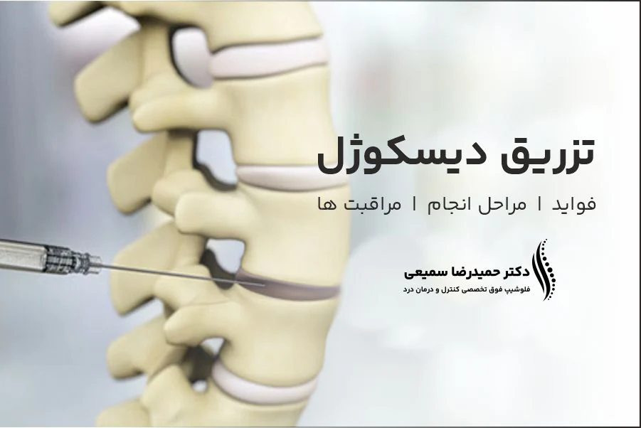 فواید تزریق دیسکوژل