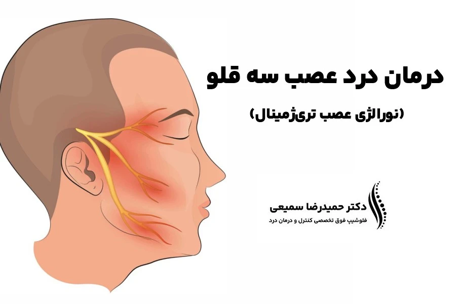 درمان درد عصب 3 قلو