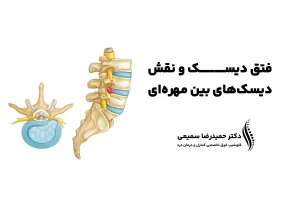 نقش دیسک های بین مهره ای