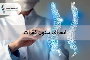 انحراف ستون فقرات