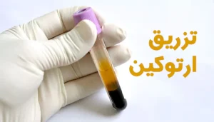 ارتوکین تراپی