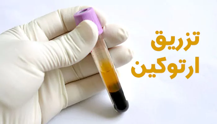 ارتوکین تراپی